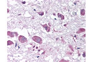 Anti-HCRT / Orexin antibody IHC of human brain, hypothalamus.