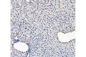 IHC analysis of ADK using anti-ADK antibody (ABIN4886430). (ADK anticorps  (AA 165-351))