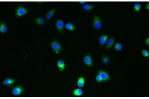 Immunofluorescent analysis of A2780 cells using ABIN7174666 at dilution of 1:100 and Alexa Fluor 488-congugated AffiniPure Goat Anti-Rabbit IgG(H+L) (SLC35B4 anticorps  (AA 174-200))