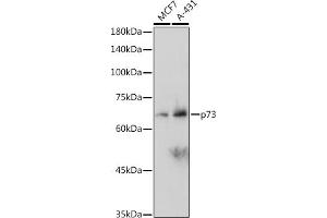 Western blot analysis of extracts of various cell lines, using p73 antibody (ABIN1678945, ABIN1678944, ABIN7101487 and ABIN7101488) at 1:1000 dilution. (Tumor Protein p73 anticorps)