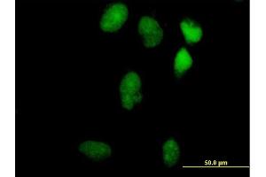 Immunofluorescence of purified MaxPab antibody to LIN9 on HeLa cell.