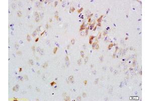 Formalin-fixed and paraffin embedded rat brain labeled with Anti-GDNF-Receptor-alpha-2 Polyclonal Antibody, Unconjugated 1:200 followed by conjugation to the secondary antibody and DAB staining