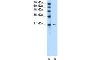Western Blotting (WB) image for anti-Chromosome 20 Open Reading Frame 24 (C20ORF24) antibody (ABIN2463276) (C20ORF24 anticorps)