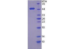 SDS-PAGE analysis of Human WT1 Protein. (WT1 Protéine)