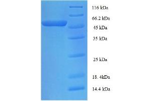SDS-PAGE (SDS) image for Proprotein Convertase Subtilisin/kexin Type 5 (PCSK5) (AA 117-452) protein (His-SUMO Tag) (ABIN5710073)