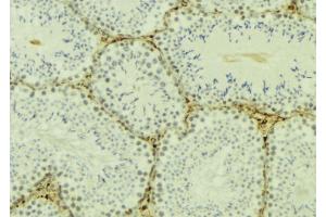 ABIN6277174 at 1/100 staining Mouse testis tissue by IHC-P. (TBP anticorps  (N-Term))