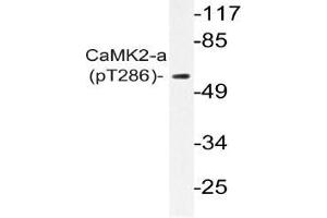 Western blot (WB) analysis of p-CaMK2-a antibody in extracts from A431 EGF cells (CAMK2A anticorps  (pThr286))