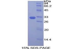SDS-PAGE analysis of Human DOCK1 Protein. (DOCK1 Protéine)