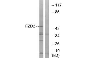 Western blot analysis of extracts from HeLa cells, using FZD2 antibody. (FZD2 anticorps  (Internal Region))