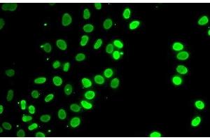 Immunofluorescence analysis of HeLa cells using SEPT7 Polyclonal Antibody (Septin 7 anticorps)