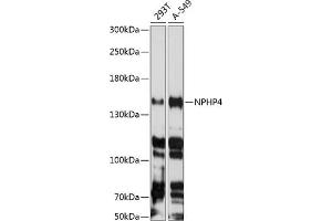Western blot analysis of extracts of various cell lines, using NPHP4 antibody  at 1:3000 dilution. (NPHP4 anticorps  (AA 1247-1426))