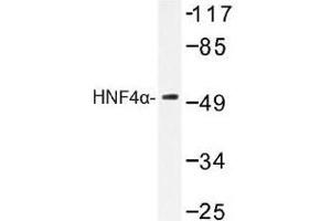 Image no. 1 for anti-Hepatocyte Nuclear Factor 4, alpha (HNF4A) antibody (ABIN317780) (HNF4A anticorps)