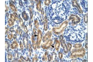 Image no. 1 for anti-Hematopoietic Cell-Specific Lyn Substrate 1 (HCLS1) (AA 28-77) antibody (ABIN202645)