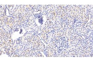Detection of TNS1 in Human Kidney Tissue using Polyclonal Antibody to Tensin 1 (TNS1)