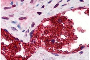 Human Placenta, Erythrocytes (formalin-fixed, paraffin-embedded) stained with SLC4A1 antibody ABIN290275 at 10 ug/ml followed by biotinylated goat anti-rabbit IgG secondary antibody ABIN481713, alkaline phosphatase-streptavidin and chromogen. (Band 3/AE1 anticorps  (N-Term))