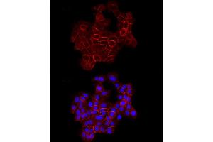 Immunofluorescence analysis of A-431 cells using E-Cadherin Rabbit pAb  at dilution of 1:100 (40x lens).