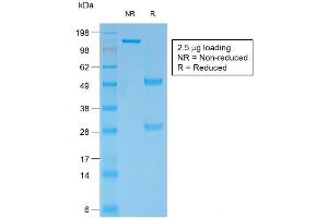 SDS-PAGE Analysis of Purified BCL2 Mouse Recombinant Monoclonal Antibody ABIN6383841. (Recombinant Bcl-2 anticorps)