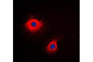 Immunofluorescent analysis of Cytokeratin 7 staining in HeLa cells. (Cytokeratin 7 anticorps  (C-Term))