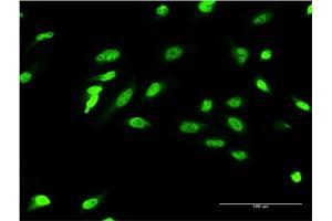Immunofluorescence of monoclonal antibody to ZIC4 on HeLa cell.