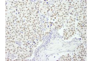 Immunohistochemistry (IHC) image for anti-REST Corepressor 3 (RCOR3) (AA 445-495) antibody (ABIN7449047) (RCOR3 anticorps  (AA 445-495))