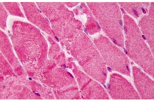 Human Skeletal Muscle: Formalin-Fixed, Paraffin-Embedded (FFPE) (RNF2 anticorps  (AA 189-201))