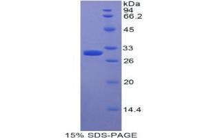 SDS-PAGE analysis of Human Myosin IE Protein. (MYO1E Protéine)