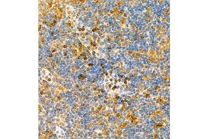 Immunohistochemistry of paraffin embedded rat lymph node using MHC-II (ABIN7074245) at dilution of 1:1800 (400x lens)