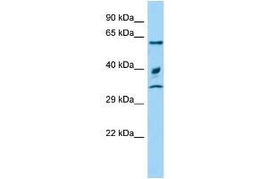 Host: Rabbit Target Name: Arih2 Sample Type: Rat Testis lysates Antibody Dilution: 1. (ARIH2 anticorps  (C-Term))