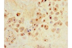 Immunohistochemistry of paraffin-embedded human placenta tissue using ABIN7176688 at dilution of 1:100