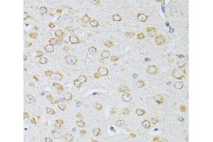 Immunohistochemistry of paraffin-embedded Mouse brain using NTS Polyclonal Antibody at dilution of 1:100 (40x lens). (Neurotensin anticorps)