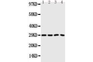 Anti-Carbonic Anhydrase III antibody, Western blotting Lane 1: SMMC Cell Lysate Lane 2: HELA Cell Lysate Lane 3: SW620 Cell Lysate Lane 4: SCG Cell Lysate (CA3 anticorps  (N-Term))