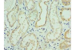 Immunohistochemistry of paraffin-embedded human kidney tissue using ABIN7176712 at dilution of 1:100 (SLC39A6 anticorps  (AA 170-320))
