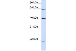 C19ORF46 antibody used at 1 ug/ml to detect target protein. (C19orf46 anticorps  (N-Term))