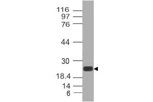 Image no. 1 for anti-C-Type Lectin Domain Family 4, Member E (CLEC4E) antibody (ABIN5026978) (CLEC4E anticorps)