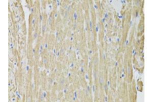 Immunohistochemistry of paraffin-embedded rat heart using FHIT antibody (ABIN1872693) at dilution of 1:100 (40x lens). (FHIT anticorps)