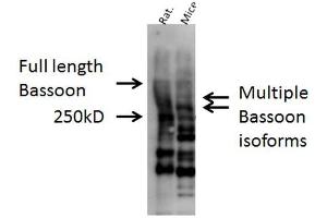 Western blot analysis of Mouse, Rat brain cell lysates showing detection of Bassoon protein using Rabbit Anti-Bassoon Polyclonal Antibody . (Bassoon anticorps  (AA 786-1041) (PE))