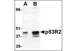 Western blot analysis of p53R2 expression in A431 cell lysate with this product at (A) 0. (RRM2B anticorps  (N-Term))