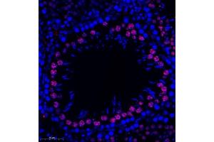 Immunofluorescence of paraffin embedded rat testis using HRP3 (ABIN7074198) at dilution of 1:1000 (300x lens)