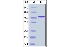 Biotinylated Human APRIL, Fc,Avitag on  under reducing (R) condition.