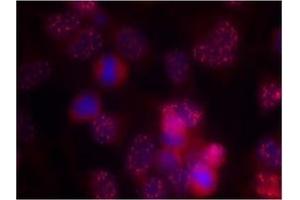 Image no. 2 for anti-Protein Kinase C, delta (PKCd) (AA 643-647) antibody (ABIN197565) (PKC delta anticorps  (AA 643-647))