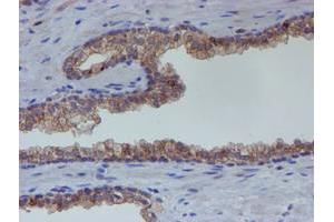 Image no. 1 for anti-Estrogen Receptor 1 (ESR1) antibody (ABIN1498060)