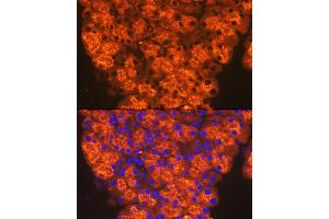 Immunofluorescence analysis of mouse pancreas cells using CTRL Rabbit mAb (ABIN7266395) at dilution of 1:100 (40x lens).