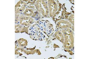 Immunohistochemistry of paraffin-embedded rat kidney using CDH6 antibody (ABIN5974784) at dilution of 1/100 (40x lens). (CDH6 anticorps)