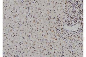 ABIN6273567 at 1/100 staining Human liver tissue by IHC-P. (ZNF709 anticorps  (N-Term))