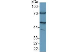 Rabbit Detection antibody from the kit in WB with Positive Control:  Sample Rat Heart lysate.