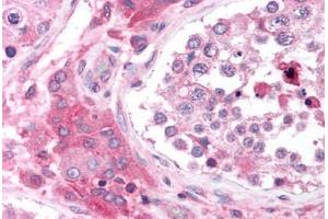 Human Testis (formalin-fixed, paraffin-embedded) stained with CACNB2 antibody ABIN214732 at 5 ug/ml followed by biotinylated goat anti-rabbit IgG secondary antibody ABIN481713, alkaline phosphatase-streptavidin and chromogen.