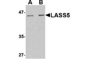 Western Blotting (WB) image for anti-LAG1 Homolog, Ceramide Synthase 5 (LASS5) (N-Term) antibody (ABIN1031436) (LASS5 anticorps  (N-Term))