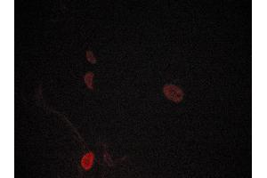 ABIN6269260 staining lovo cells by ICC/IF.