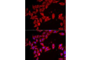 Immunofluorescence analysis of HeLa cell using SLC35A2 antibody. (SLC35A2 anticorps)