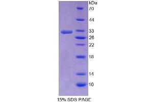 SDS-PAGE analysis of Human SHP Protein. (NR0B2 Protéine)